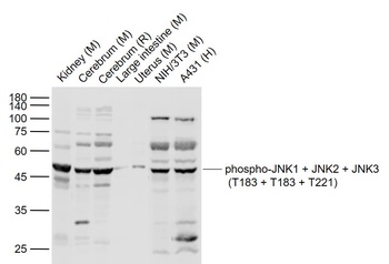 JNK1 (phospho-T183) antibody