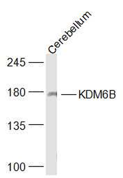 KDM6B Rabbit Polyclonal Antibody