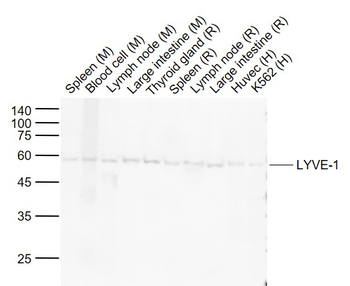 LYVE-1 Rabbit Polyclonal Antibody