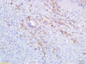 HLA-A Rabbit Polyclonal Antibody
