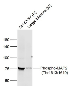 Phospho-MAP2 (Thr1613/1619) Rabbit Polyclonal Antibody
