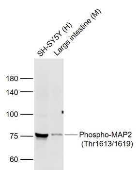 MAP2 (phospho-Thr1613/1619) antibody