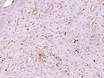 NSUN5P1 Rabbit Polyclonal Antibody