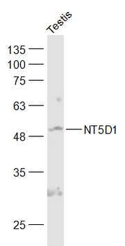NT5D1 Rabbit Polyclonal Antibody
