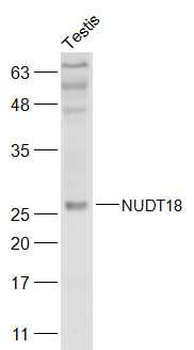 NUDT18 Rabbit Polyclonal Antibody