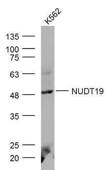 NUDT19 Rabbit Polyclonal Antibody