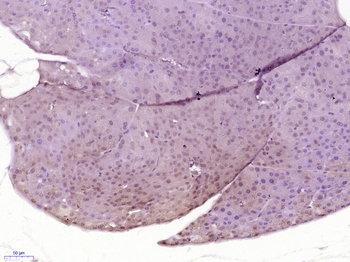 NVL Rabbit Polyclonal Antibody