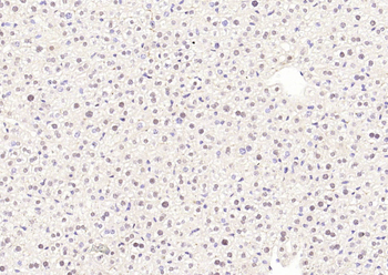 NFKB p65 Rabbit Polyclonal Antibody