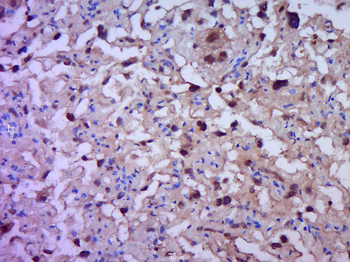 NFKB p65 Rabbit Polyclonal Antibody