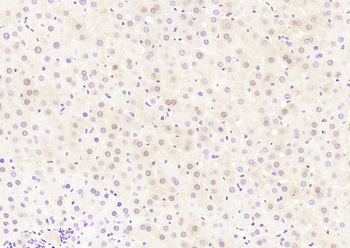 NFKB p65 Rabbit Polyclonal Antibody