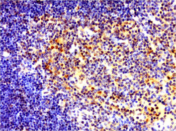 NFKB p65 Rabbit Polyclonal Antibody
