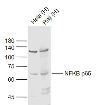 NFKB p65 Rabbit Polyclonal Antibody