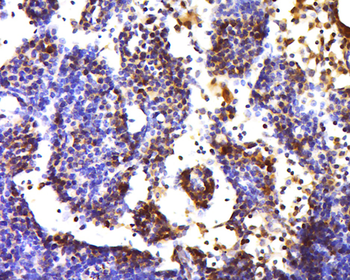 NFKB p65 Rabbit Polyclonal Antibody