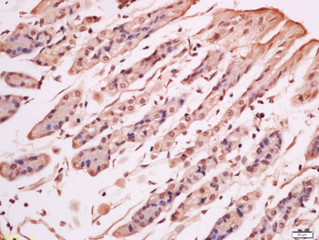 NFKB p65 Rabbit Polyclonal Antibody