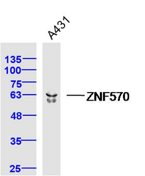 ZNF570 Rabbit Polyclonal Antibody