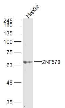 ZNF570 Rabbit Polyclonal Antibody