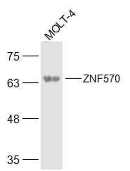 ZNF570 Rabbit Polyclonal Antibody