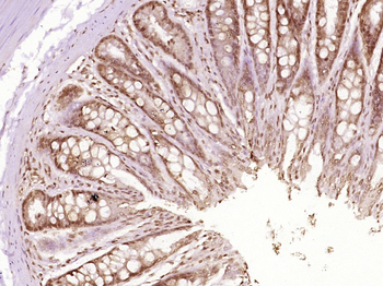 OASL/TRIP14 Rabbit Polyclonal Antibody