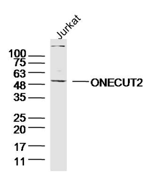 ONECUT2 Rabbit Polyclonal Antibody