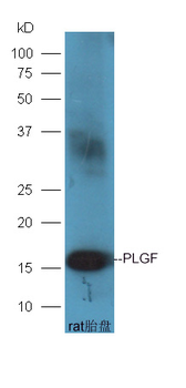 PLGF Rabbit Polyclonal Antibody