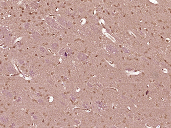 PRPSAP2 Rabbit Polyclonal Antibody