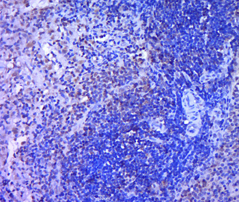 PRSS23 Rabbit Polyclonal Antibody