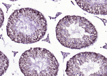 PSMD14 Rabbit Polyclonal Antibody