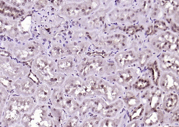PSMD14 Rabbit Polyclonal Antibody