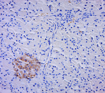 PSME2 Rabbit Polyclonal Antibody