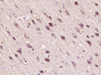 PTPD1 Rabbit Polyclonal Antibody