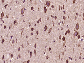 PTPD1 Rabbit Polyclonal Antibody