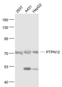 PTPN12 Rabbit Polyclonal Antibody