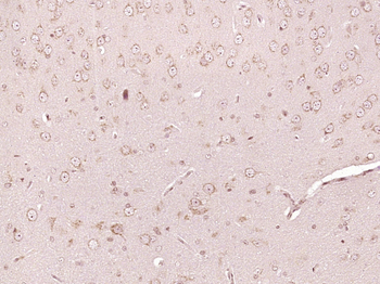 PTS Rabbit Polyclonal Antibody