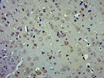 PXK Rabbit Polyclonal Antibody