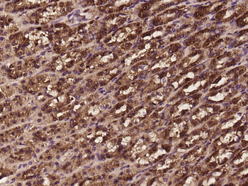 DLAT Rabbit Polyclonal Antibody