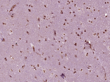 PBXIP1 Rabbit Polyclonal Antibody