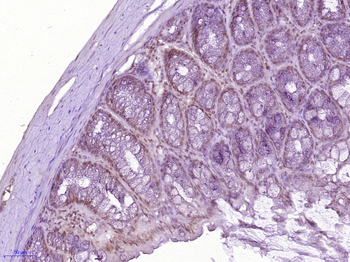 PCBD1 Rabbit Polyclonal Antibody