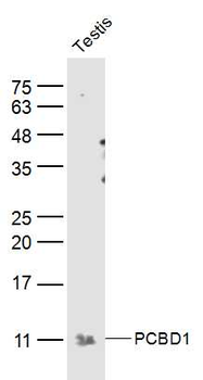 PCBD1 Rabbit Polyclonal Antibody