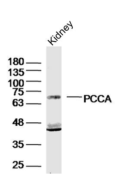PCCA Rabbit Polyclonal Antibody