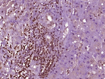 PRDM7 Rabbit Polyclonal Antibody