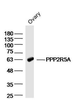 PPP2R5A Rabbit Polyclonal Antibody