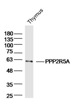 PPP2R5A Rabbit Polyclonal Antibody