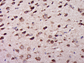 PPP2R5E Rabbit Polyclonal Antibody