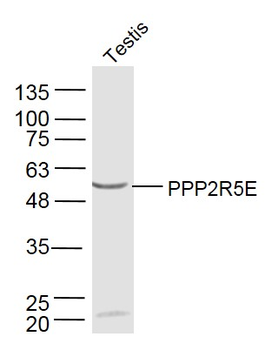 PPP2R5E Rabbit Polyclonal Antibody
