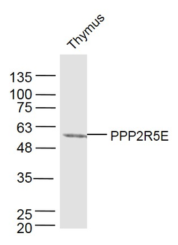 PPP2R5E Rabbit Polyclonal Antibody