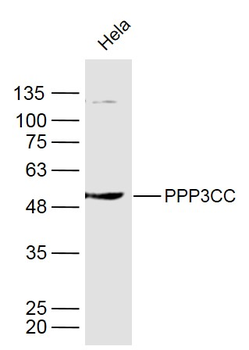 PPP3CC Rabbit Polyclonal Antibody