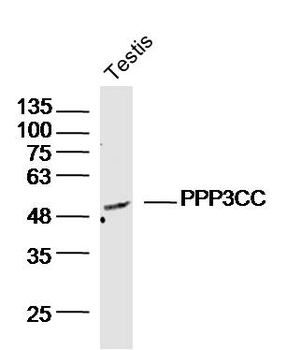 PPP3CC Rabbit Polyclonal Antibody