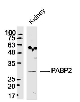 PABP2 Rabbit Polyclonal Antibody