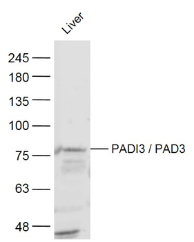 PADI3 / PAD3 Rabbit Polyclonal Antibody