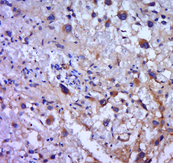 PADI6 Rabbit Polyclonal Antibody